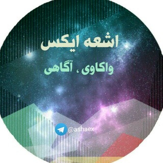 اشعه ایکس