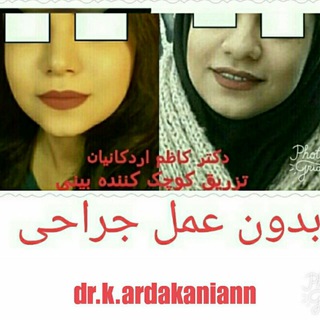 کوچک کردن بینی بدون عمل جراحی